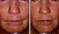 Before After Lunch Hour Facelift