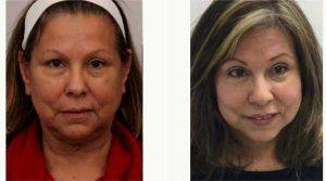Doctor Connie Hiers, MD, San Antonio Plastic Surgeon - 65 Year Old Woman Treated With Facelift Before And After