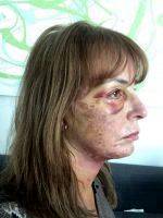 Dr Miguel Delgado Cosmetic Procedures For Face Photo Result