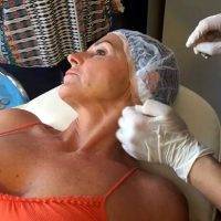 Facelift Can Turn The Clock Back