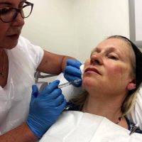 Facelift Procedure Can Last 5 To 10 Years And It Only Takes An Hour