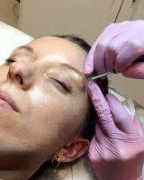 Rejuvenate Your Facial Appearance By Tightening The Muscles In Your Face