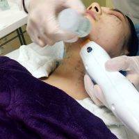 Thermage Treats Telltale Signs Of Aging In The Face