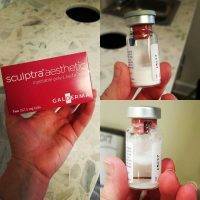 60 Minute Facelift With Sculptra