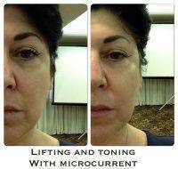 Lifting And Toning With Microcurrent