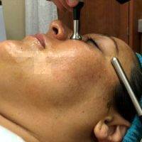 Microcurrent Facelift At Home