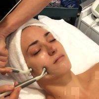 Microcurrent Facial Toning Before And After (6)