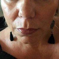 What Is A Weekend Facelift Before And After (2)