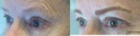55-64 year old woman treated with Permanent Makeup