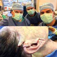 SMAS Facelift At Dallas Plastic Surgery Institute By Rod Rohrich