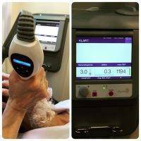 Thermage CPT is a non-invasive radiofrequency therapy