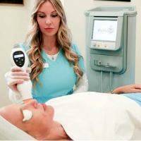Thermage Cpt Skin Tightening