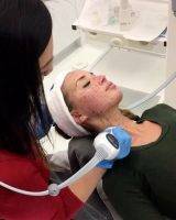 Thermage First Pioneered The Non-invasive Treatment Of Wrinkles Using Radiofrequency Energy
