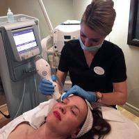 Thermage For Treatment Of Wrinkles Around The Eyes