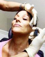 Botox Injections For Face Wrinkles