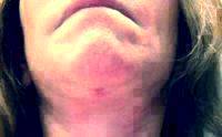 Doctor Patrick J. Byrne Lower Plastic Surgery In Face