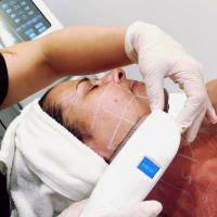 HIFU (High Intensity Focused Ultrasound) Is The Latest Clinically Proven Technology For Face Lifting