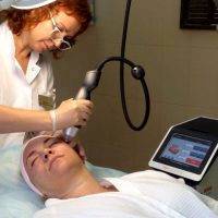 RF Lift Is Primarily Used To Treat Skin Laxity By Facial Tightening