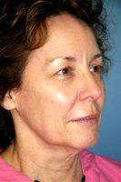 The 60 Minute Facelift Facial