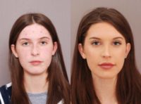 18-24 year old woman treated with Rhinoplasty and Pre-Surgery Skin Conditioning